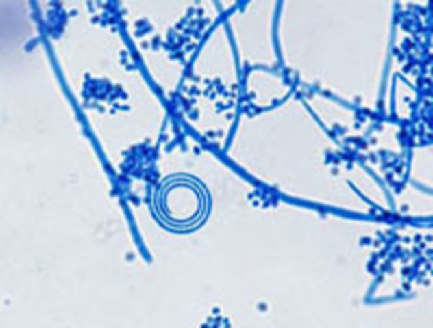 Género Trichophyton