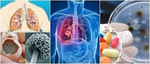 Micosis en humanos y animales