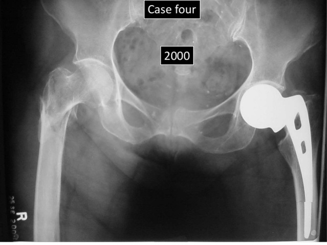 AUSTIN T. MOORE (1899-1963)