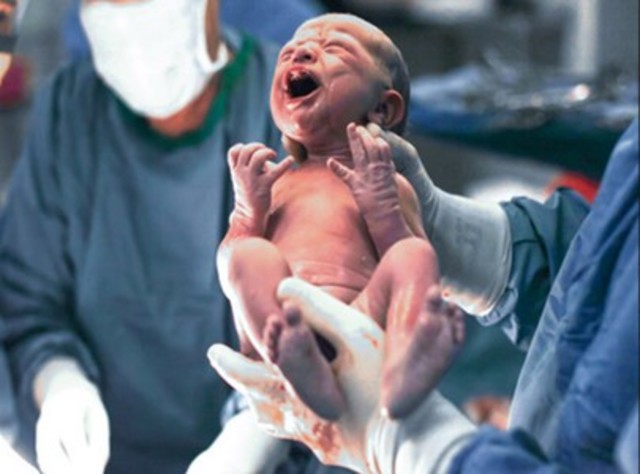 Primeras horas de vida