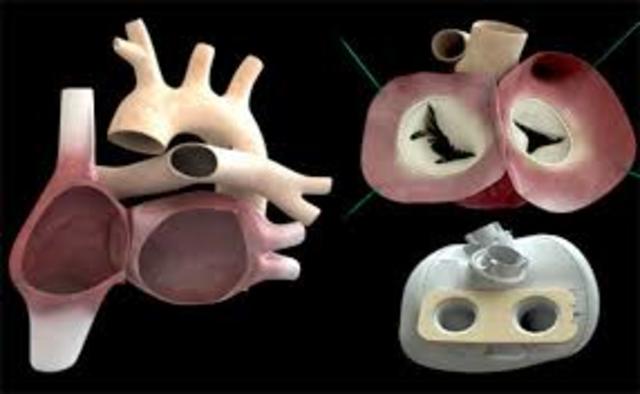 Poliuretanos En Medicina