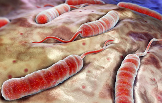 SURGE TEORÍA MIASMIATICA