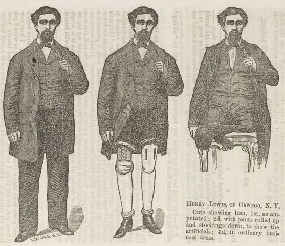 Pierna anatómica Doctor Bly.