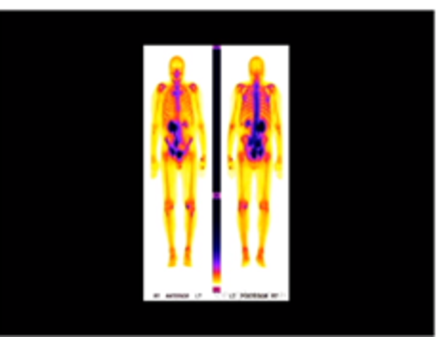 1950- Medicina nuclear