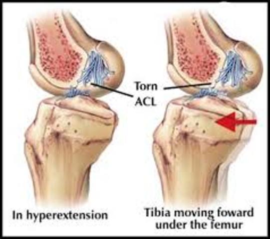 My first really bad injury