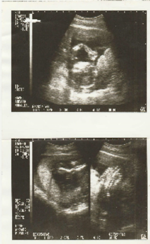 yo en la barriga de mi mama