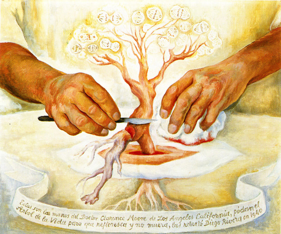 "The Hands of Dr. Moore"