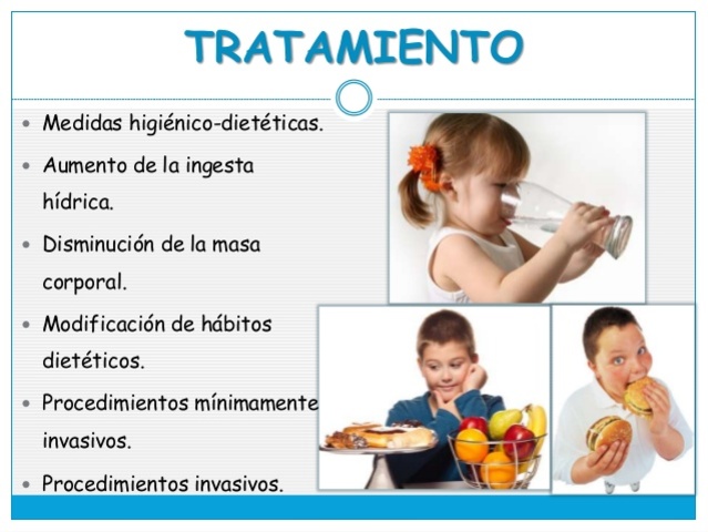 TRATAMIENTO DE LITASIS URINARIA