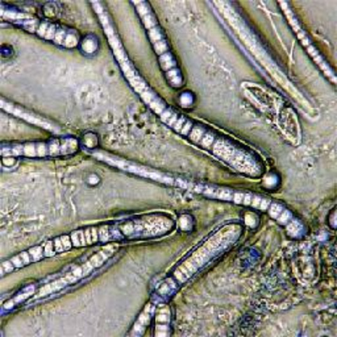 Descubrimiento de las formas de las bacterias