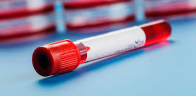 método cuantitativo