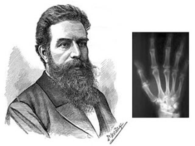 LOS RAYOS X SON DESCUBRIDOS POR ROENTGEN