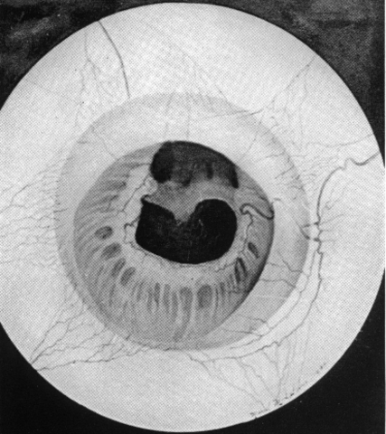 Primeros reportes de daño secundario a la tecnología