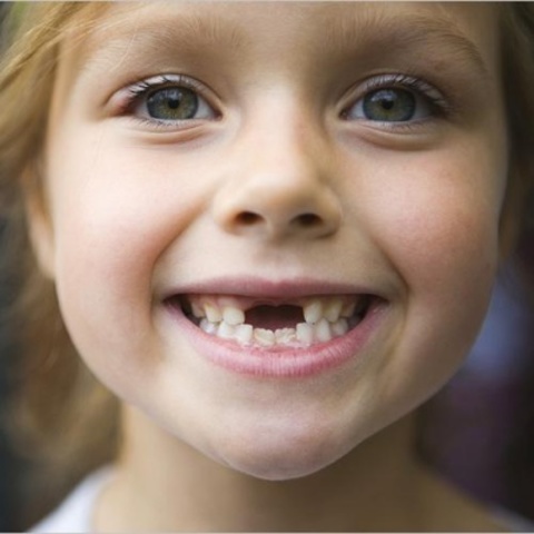 SE CAYO ME PRIMER DIENTE