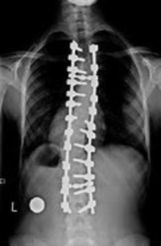 X-ray Makes it to Surgery