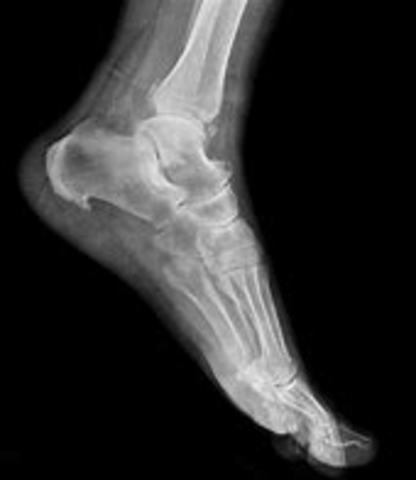 Digital X-ray Introduced