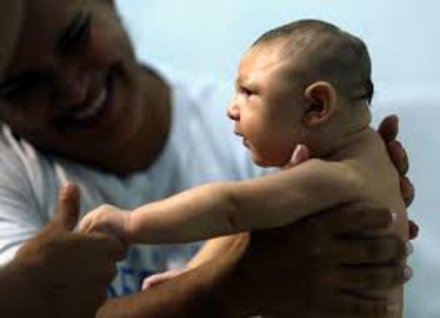 Brazil reports microcephaly
