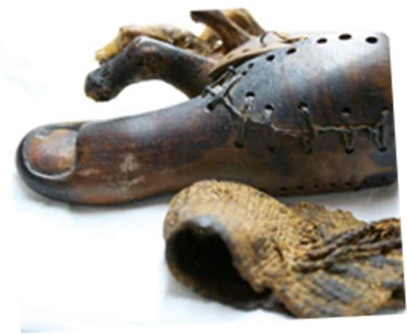 Civilización Egipcia:Ortopedia.