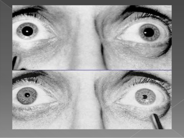 Reanimación del Paciente