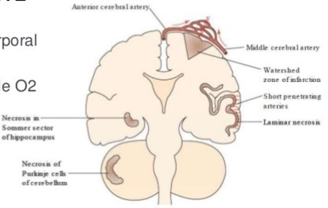 Lesiones Hipóxicas e Isquémicas