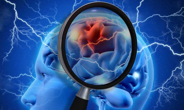 Isquemia Global Grave