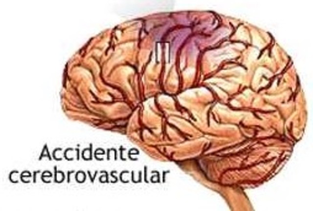 Comprenden agresiones agudas como: