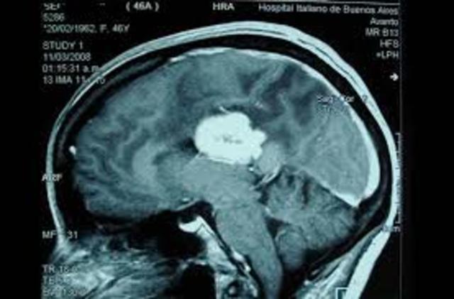 Mecanismos de Lesion