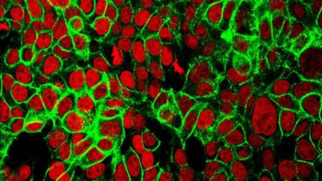 Una nueva estrategia contra el cáncer