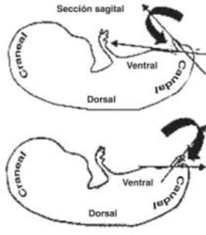 Reconocimiento del Sexo