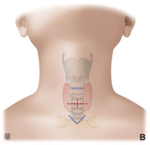 Estandarización de técnica