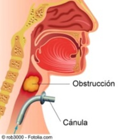 Técnica Endoscópica