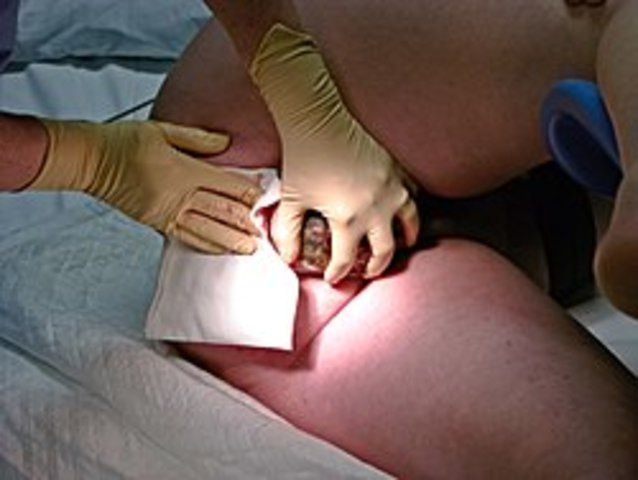 Declaracion de fortaleza