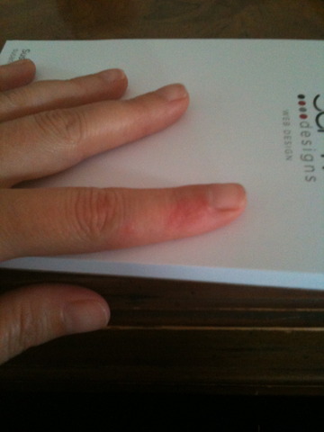 Bartonville female - rash