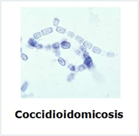 Alejandro Posadas (1894)