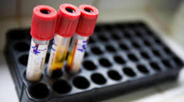 PRUEBA DE RAPIDA DE SANGRE