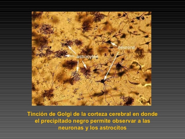 Golgi. Método de tinción.