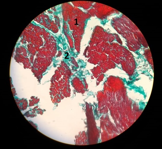 Aula 1: Tecido Epitelial de Revestimento