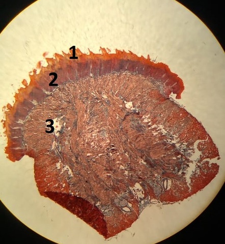 Aula 4: Tecido Nervoso