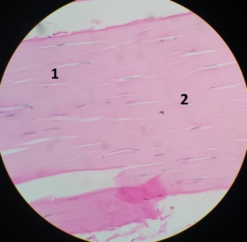 Aula 6: Tecido Conjuntivo