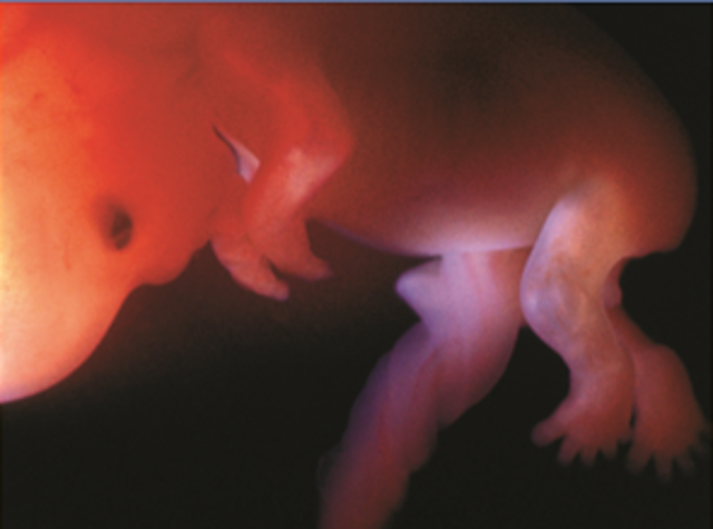 3 er mes 9.a - 10. a semanas