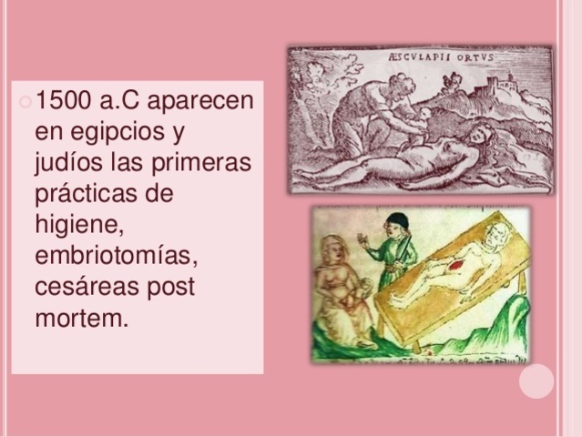 Cesárea post mortem Egipto