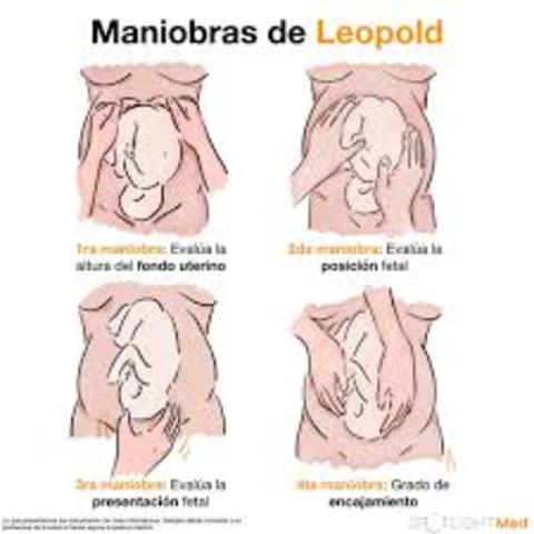 Creación Maniobras de Leopold