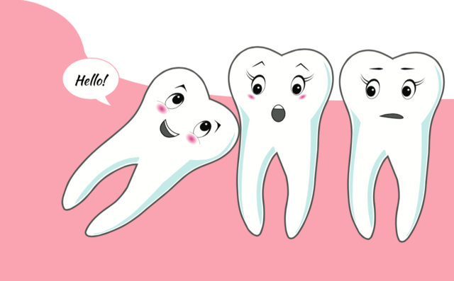 Wisdom teeth removal