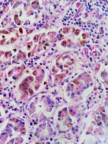 CRISPR 2.0, capaz de editar una sola base de ADN, podría curar decenas de miles de mutaciones