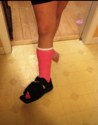 Breaking My Ankle