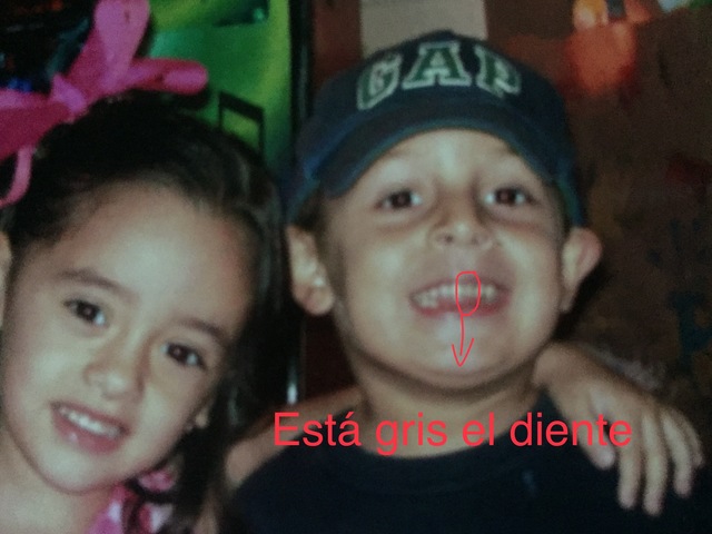 Mi hermana me rompió un diente