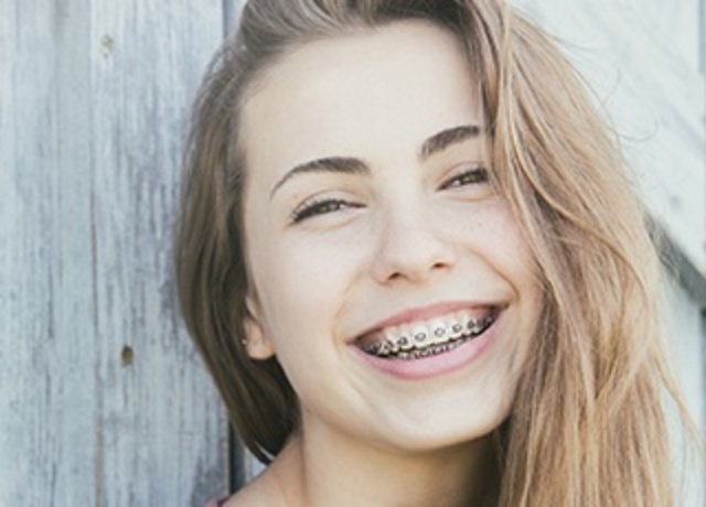 Me pusieron frenillos