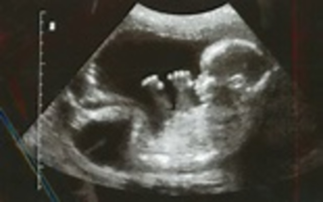 In the womb