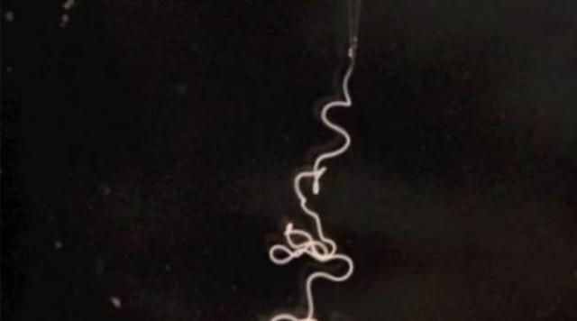 Seda de araña artificial