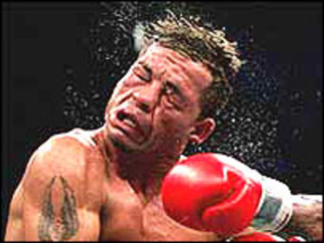 losing a tooth (funny)