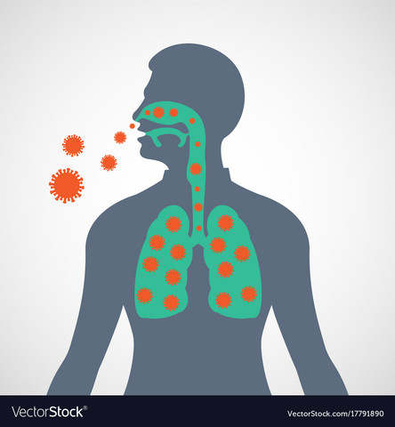 Severe Acute Respiratory Syndrome (SARS)